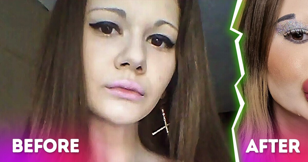 Social Media Star With World’s Largest Lips Aspires to Enlarge Them Further Social Media Star With World’s Largest Lips Aspires to Enlarge Them Further