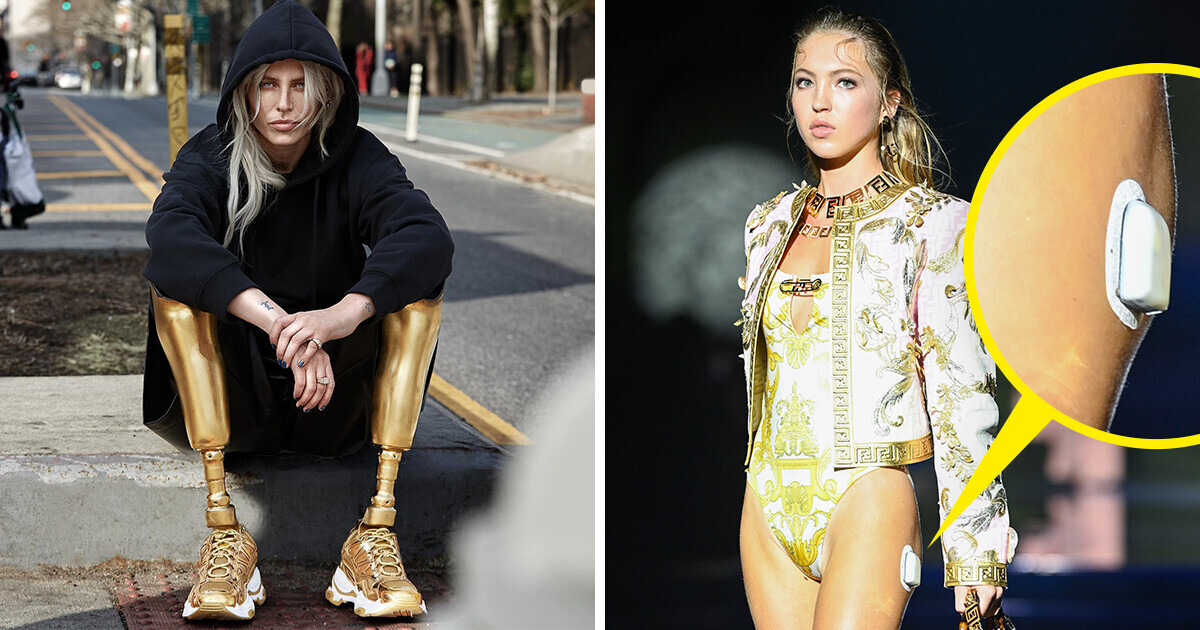 16 People With Unusual Looks Who Boldly Broke Into the Fashion World and Changed Ideals About Beauty 16 People With Unusual Looks Who Boldly Broke Into the Fashion World and Changed Ideals About Beauty