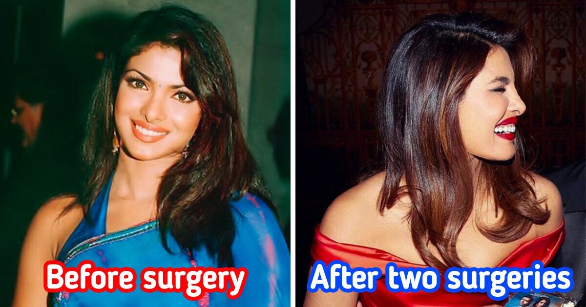“I Went into a Deep Depression,” Priyanka Chopra Openly Shared Why She Was Fired From 3 Different Movies