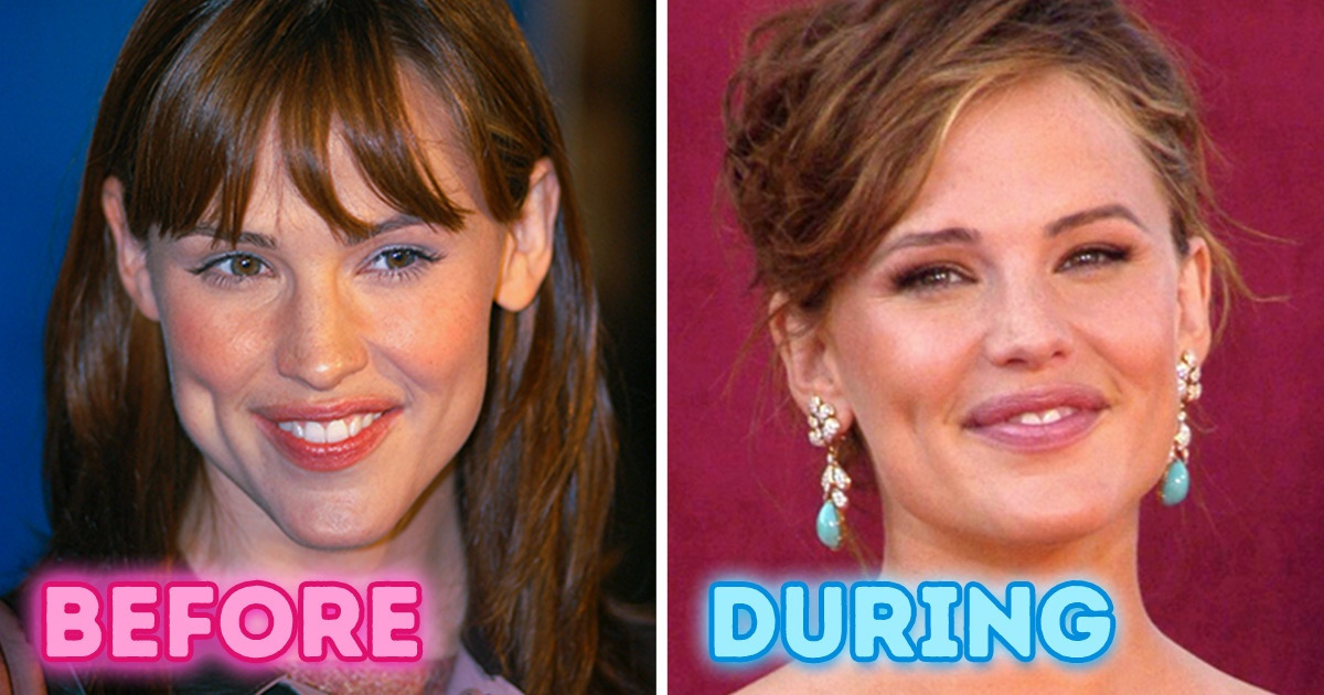 12 Stars Who Prove That Pregnancy Will Add Tons of Glow to the Face 12 Stars Who Prove That Pregnancy Will Add Tons of Glow to the Face