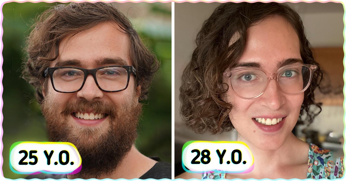 15+ People Who’ve Changed Beyond Recognition in Just a Few Years