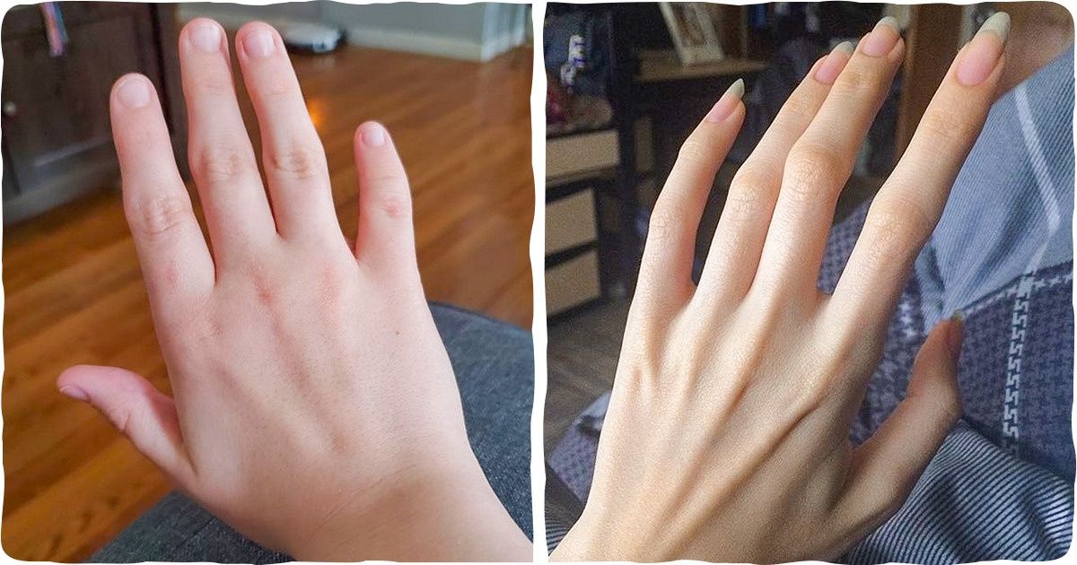 19 People That Were Born With a Distinctive Feature and a Ton of Confidence