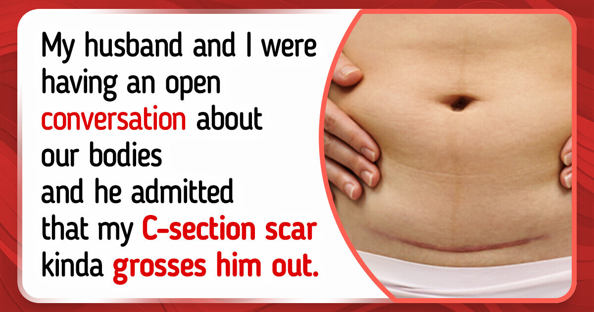 I’m Beyond Hurt, My Husband Said He is «Grossed Out» by My Postpartum Body