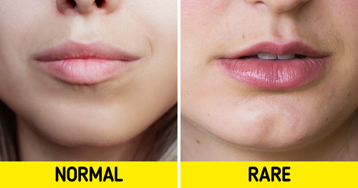 10 Uncommon Body Features That Make You Unique 10 Uncommon Body Features That Make You Unique