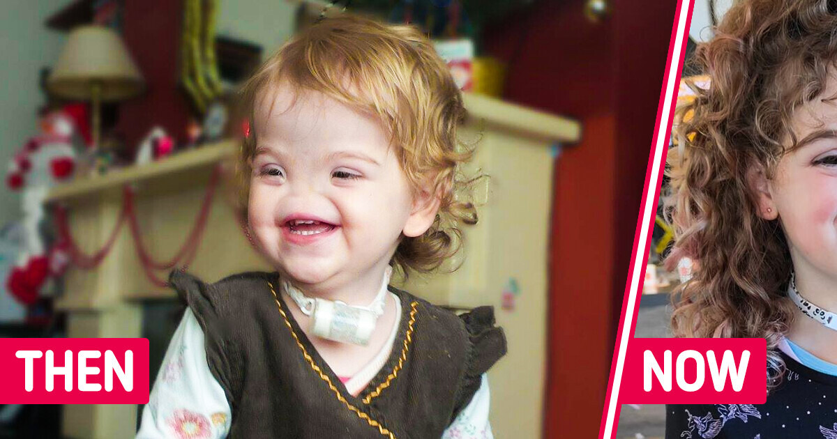 Girl Born Without a Nose Proudly Embraces “Voldemort” Moniker, Celebrating Her Unique Identity Girl Born Without a Nose Proudly Embraces “Voldemort” Moniker, Celebrating Her Unique Identity