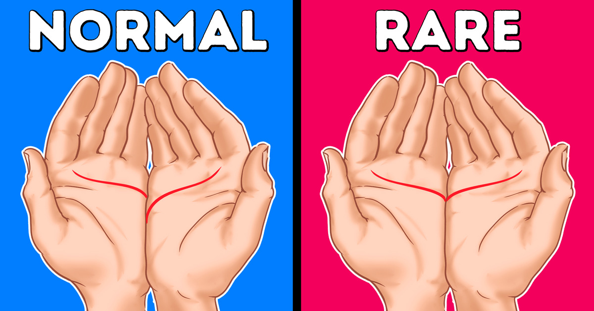 10 Body Traits Only a Tiny Percentage of You Have