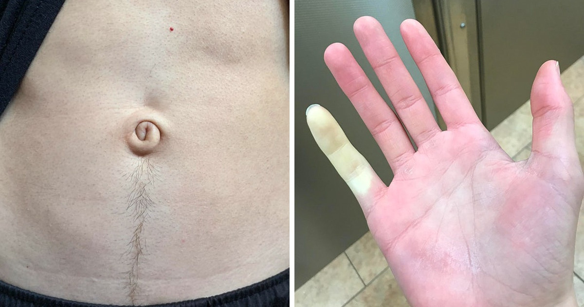 15 People Who Were Gifted With Extraordinary Body Features