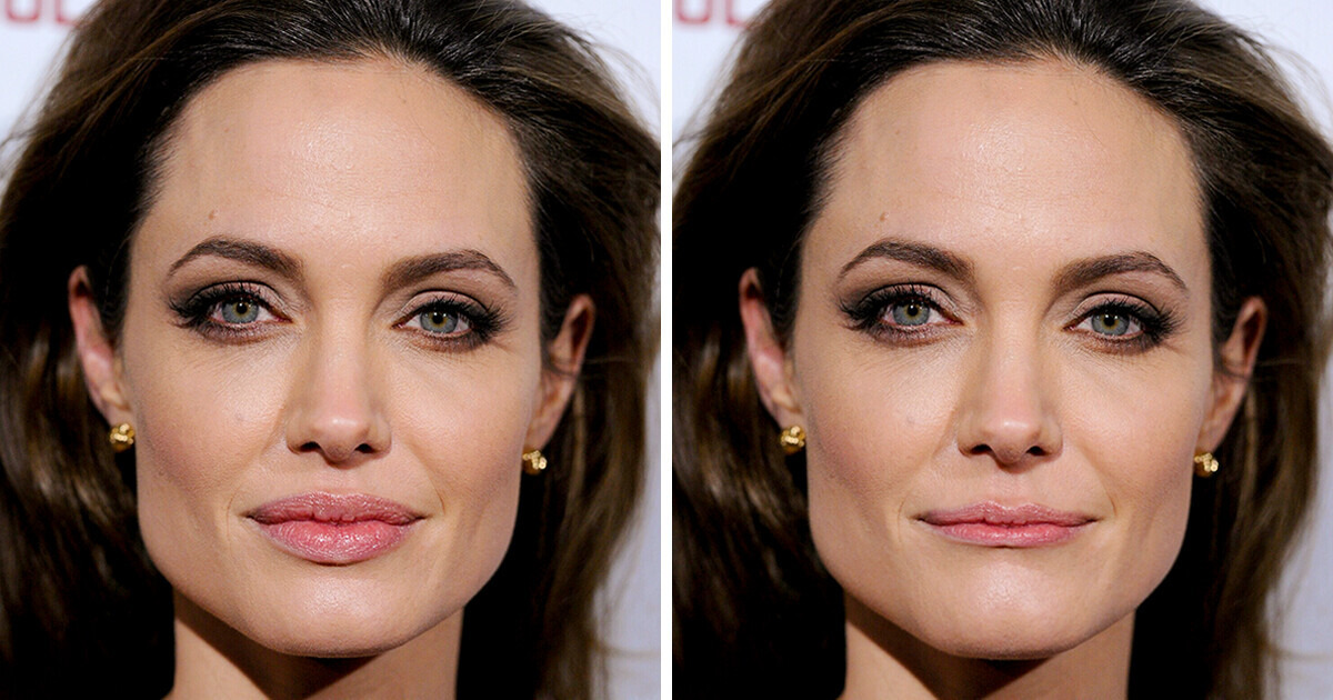 15 Stars Who Would Look Totally Different, But Equally Beautiful, If They Had Thin Lips