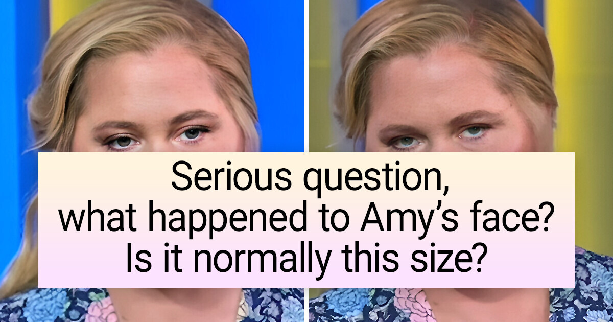 Amy Schumer Looks Unrecognizable and People Have Started To Worry About Her Health Amy Schumer Looks Unrecognizable and People Have Started To Worry About Her Health