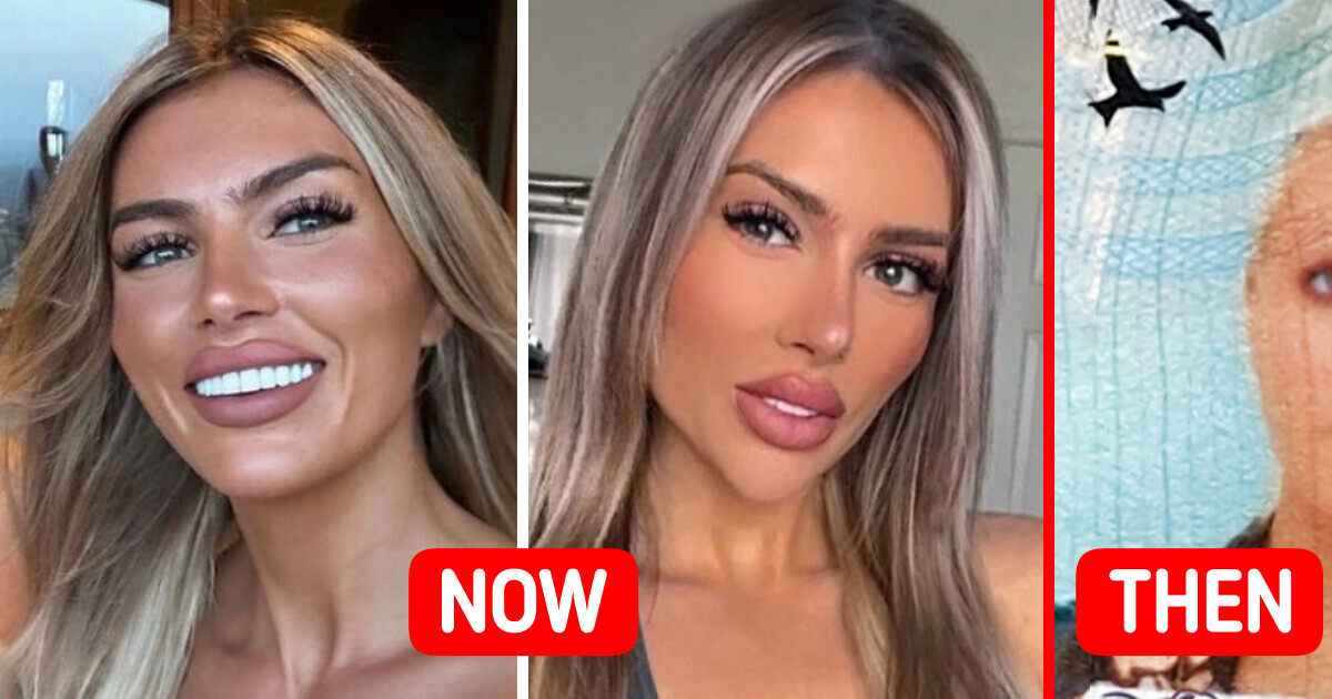 The Woman Had To Renew Her Passport After Cosmetic Enhancements As the Border Agents Refused To Believe It Was Her The Woman Had To Renew Her Passport After Cosmetic Enhancements As the Border Agents Refused To Believe It Was Her