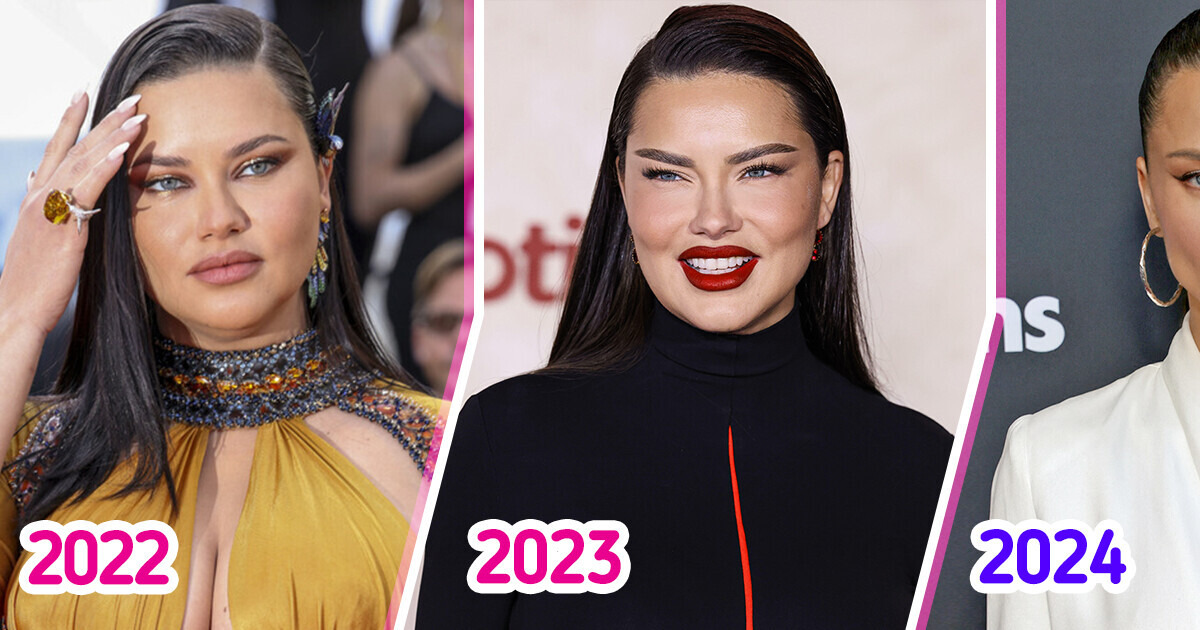 Adriana Lima’s Changed Appearance Sparks Heated Buzz Over Her Fillers Being “Dissolved” Adriana Lima’s Changed Appearance Sparks Heated Buzz Over Her Fillers Being “Dissolved”