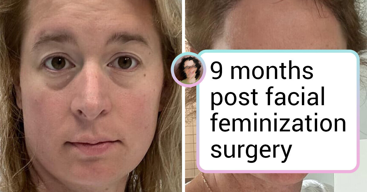 18 People Who Walked Out of the Surgeon’s Office With a Whole New Lease on Life