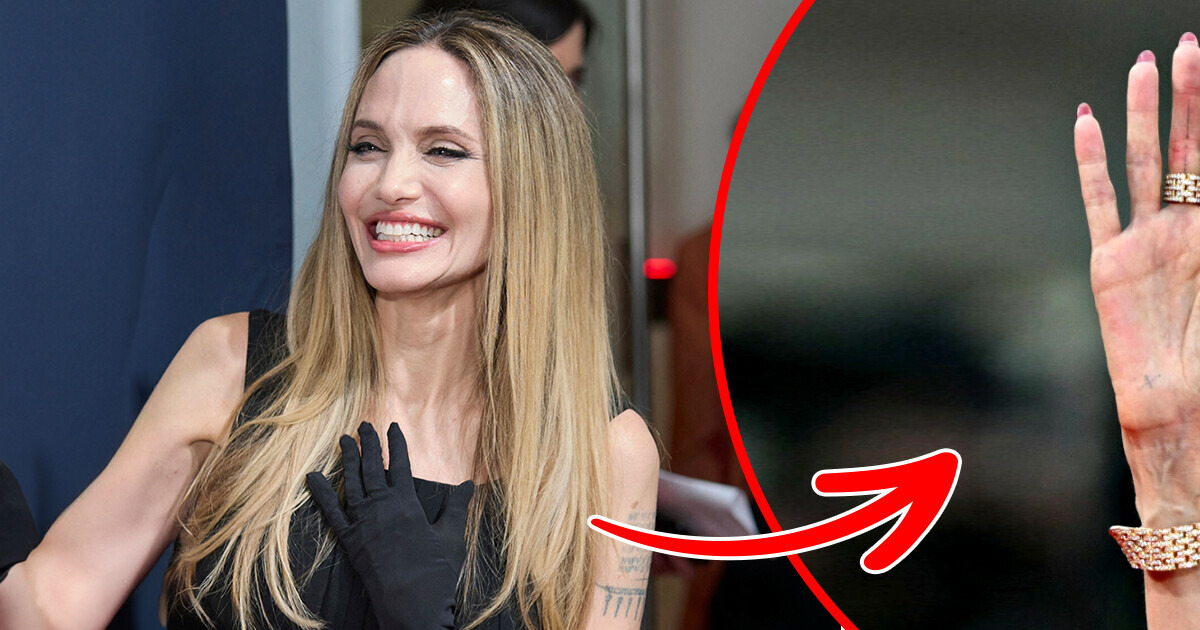 Angelina Jolie Dazzles in a Classy Gown, but People Are Concerned About Why She Covered Her Arms Angelina Jolie Dazzles in a Classy Gown, but People Are Concerned About Why She Covered Her Arms