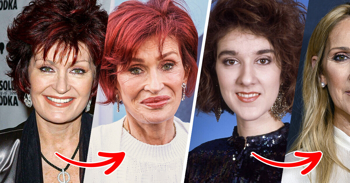 13 Celebrities Who Have Drastically Changed Since the Start of Their Careers