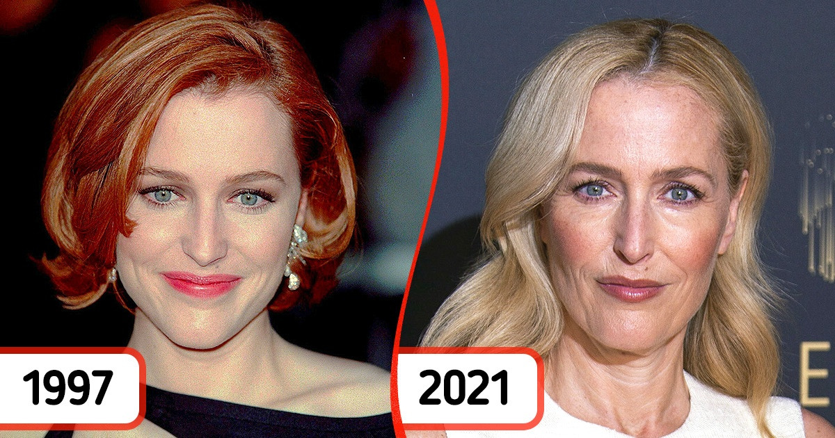 10 Lovable Stars Who Have Chosen to Stay Away from Plastic Surgery