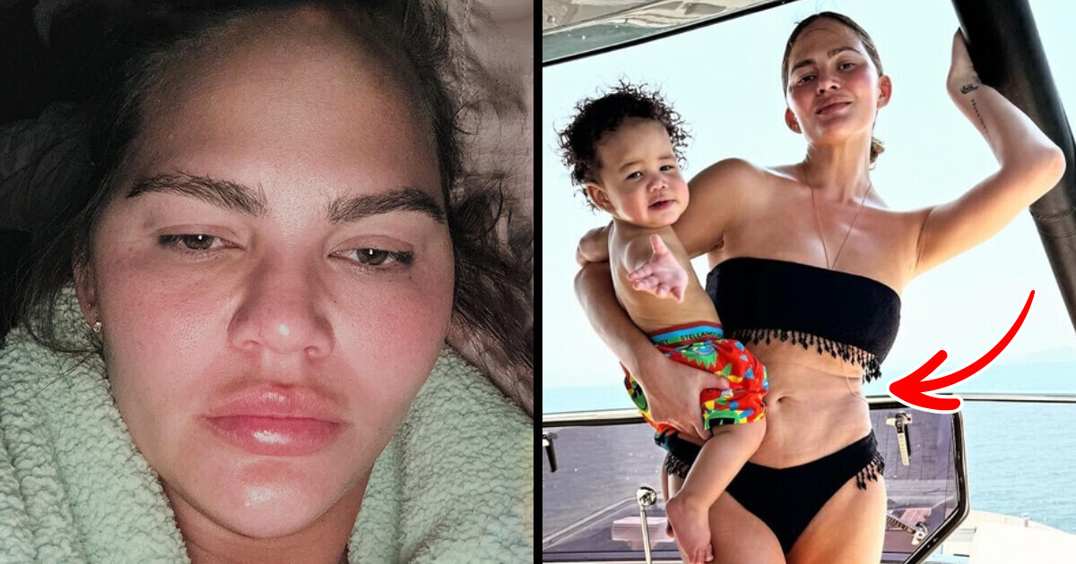 Chrissy Teigen, 38, Shares Unedited Photos, Sparking Heated Debates Chrissy Teigen, 38, Shares Unedited Photos, Sparking Heated Debates