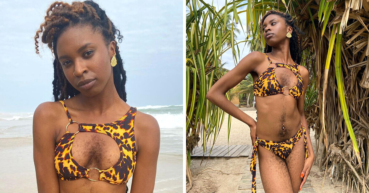 One Day She Decided Not to Shave Off Her Body Hair and Henceforth Go to the Beach in Her Natural Beauty