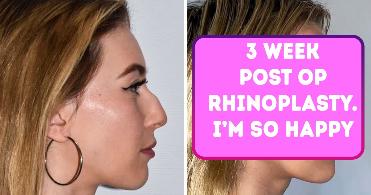 16 People Who Worked Hard to Achieve a Change They Wanted