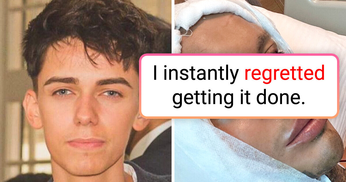 My Journey through 5 Simultaneous Plastic Surgeries, £50,000 Later