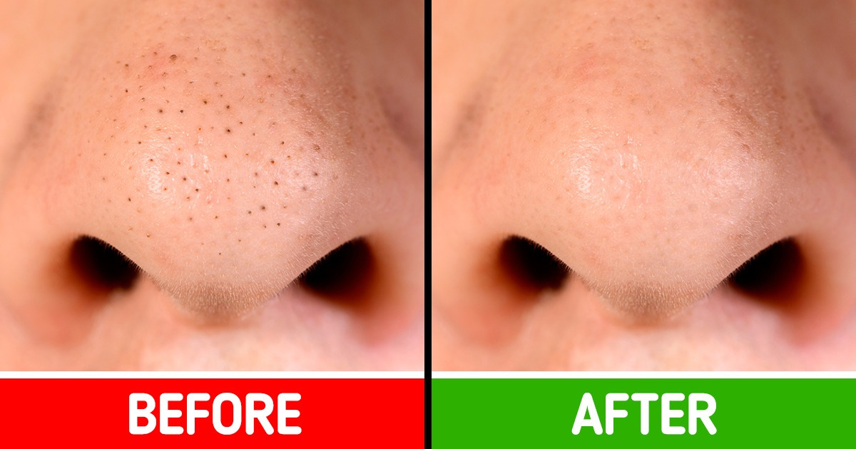 10 Ways You Can Treat Your Skin Issues Without Spending a Fortune 10 Ways You Can Treat Your Skin Issues Without Spending a Fortune