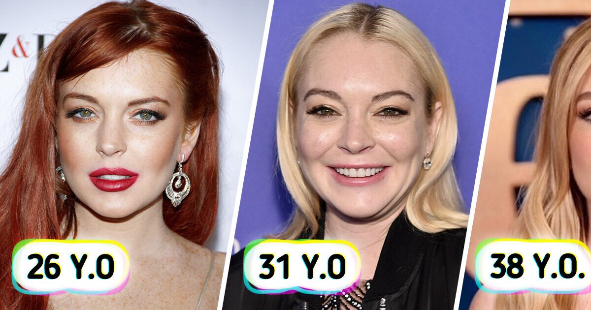 “The Best Plastic Surgery I’ve Seen!” Lindsay Lohan’s Shocking New Look Stuns “The Best Plastic Surgery I’ve Seen!” Lindsay Lohan’s Shocking New Look Stuns