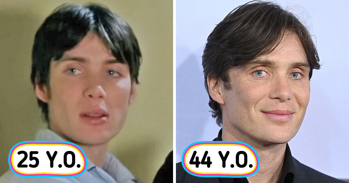 How 13 Celebrities With Unusual Features Changed Over the Years