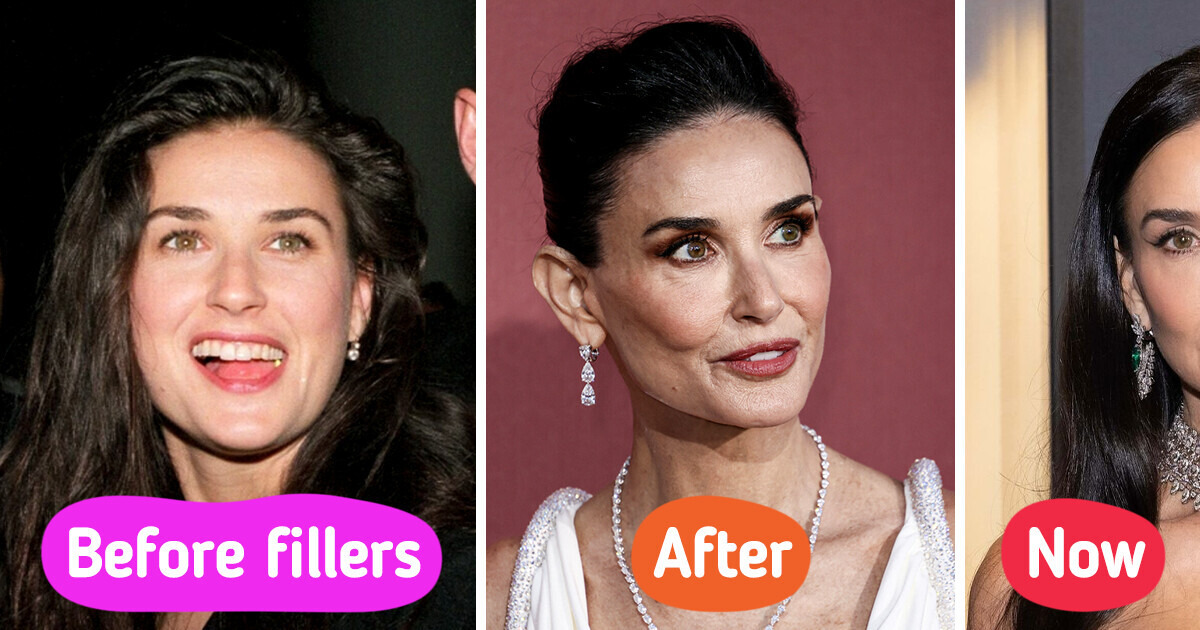 Demi Moore, 62, Flaunts in Minidress, but People Were in Awe with Her New Facial Features Demi Moore, 62, Flaunts in Minidress, but People Were in Awe with Her New Facial Features