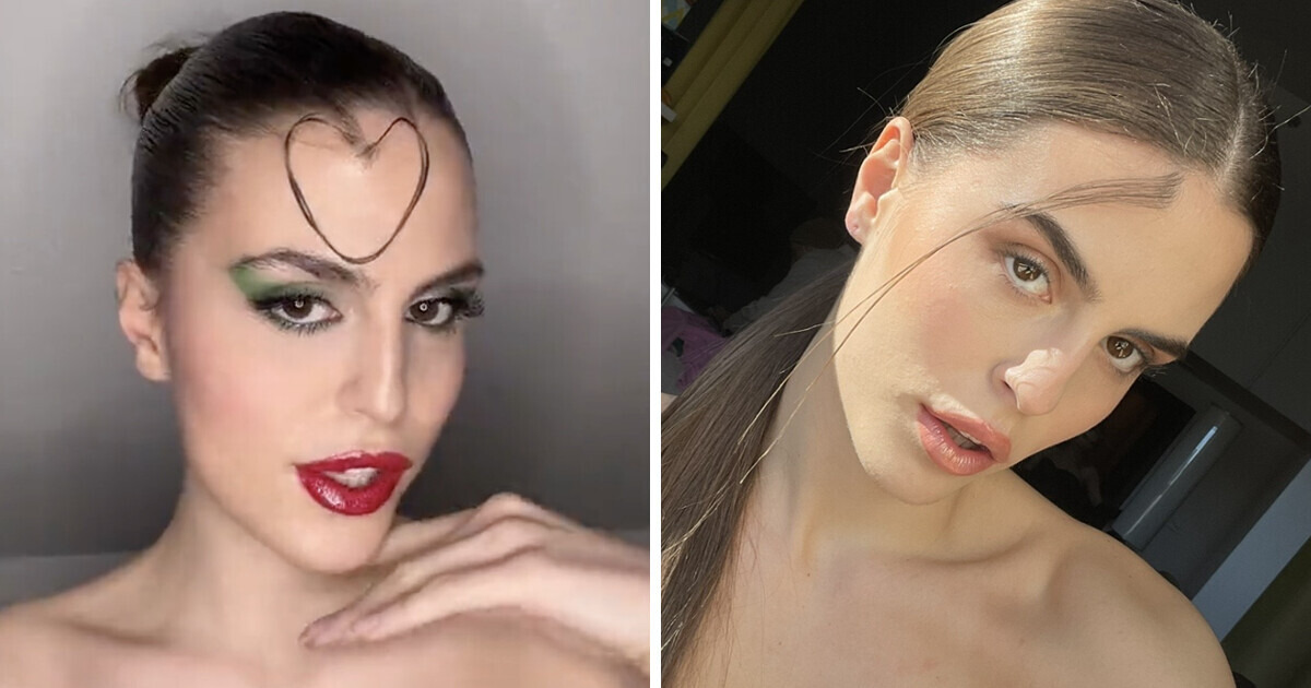 A Model With Hairy Birthmark in the Middle of Forehead Gets Asked to Remove It All the Time, but She Has a Harsh Response A Model With Hairy Birthmark in the Middle of Forehead Gets Asked to Remove It All the Time, but She Has a Harsh Response
