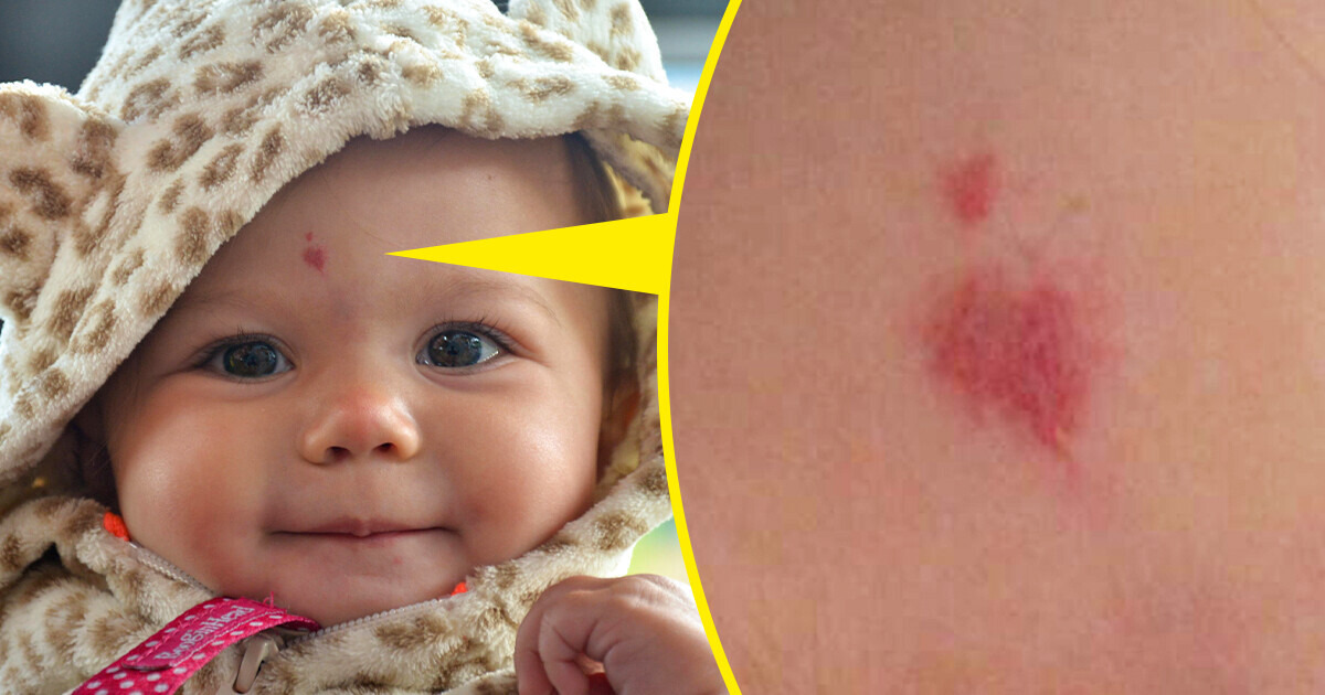 How My Niece’s Birthmark Exposed My Cheating Husband How My Niece’s Birthmark Exposed My Cheating Husband