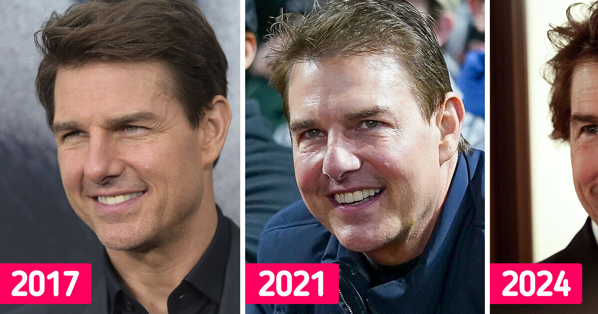 “Another Star With Far Too Many Fillers.” Tom Cruise Doesn’t Resemble Himself in the New Photos “Another Star With Far Too Many Fillers.” Tom Cruise Doesn’t Resemble Himself in the New Photos