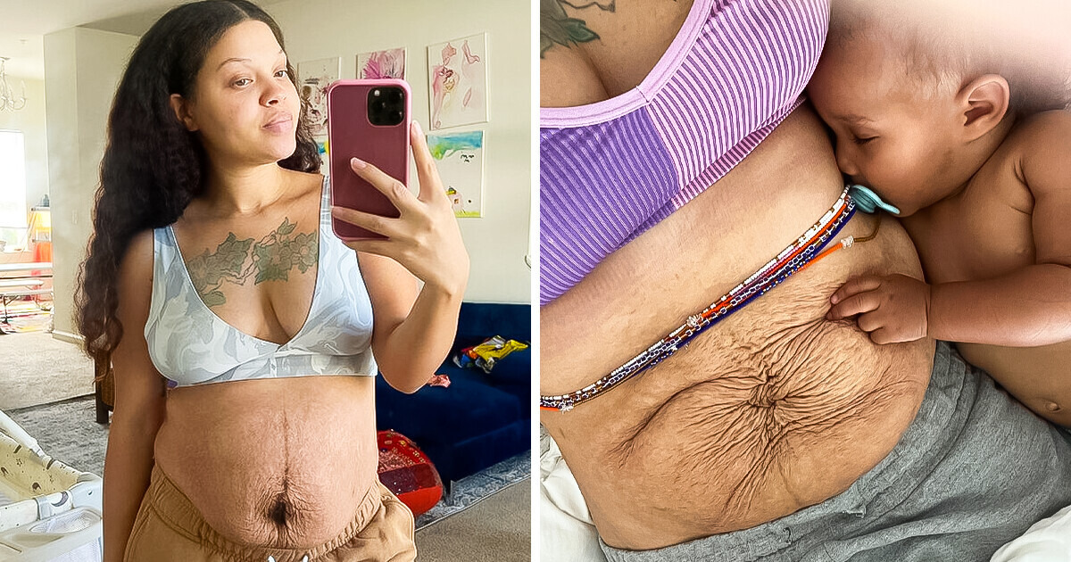 A Woman Shares Her HONEST Depiction of Postpartum Bodies A Woman Shares Her HONEST Depiction of Postpartum Bodies