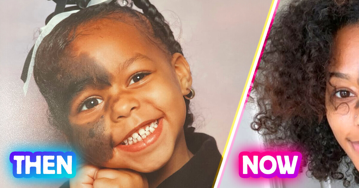 A Woman With “Werewolf Syndrome” Embraces Her Unique Beauty, and People Keep Talking About the Same Thing A Woman With “Werewolf Syndrome” Embraces Her Unique Beauty, and People Keep Talking About the Same Thing