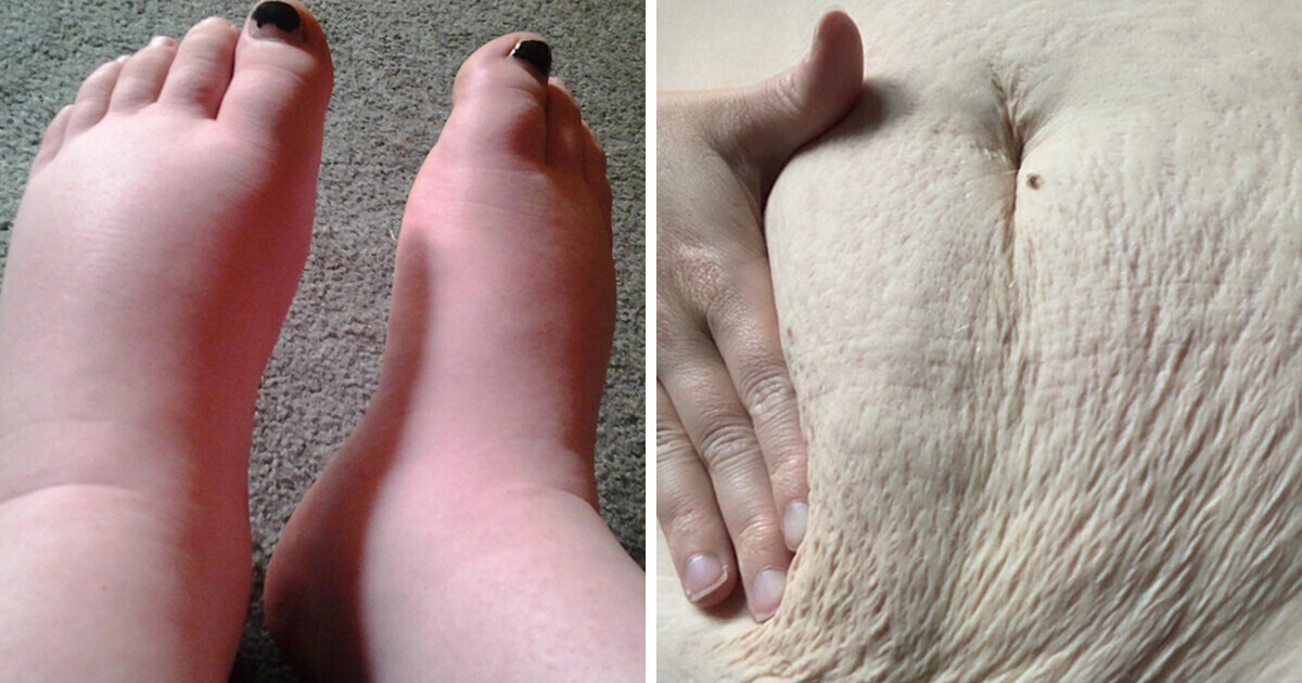 10 Real Women Share Their Uncensored Pregnancy Experiences