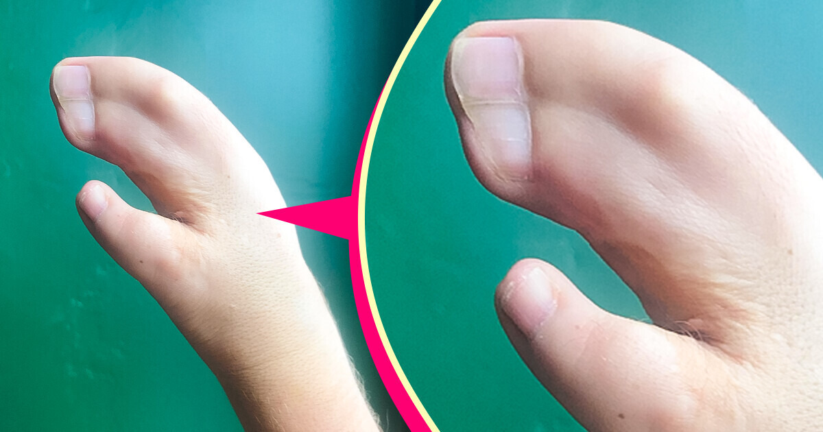 13 People with Fascinating Body Traits That Make Them Truly Unique 13 People with Fascinating Body Traits That Make Them Truly Unique