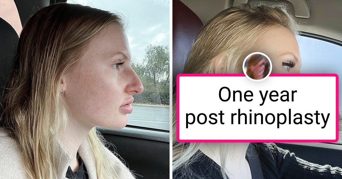 15 Wholesome Pictures and Stories of Inspiring Body Changes