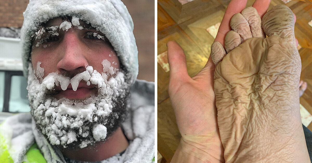 These People Need a Hug: 15+ Stories of Unrelenting Bad Luck That Will Make You Wince