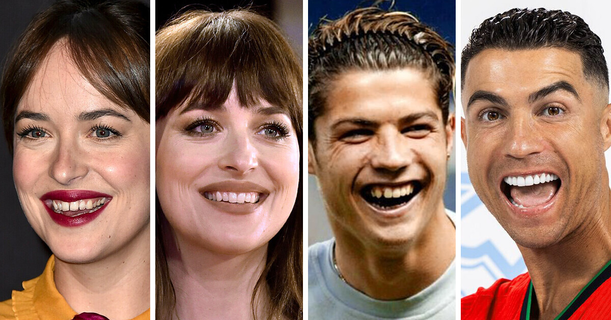 20+ Celebs Who Magically Changed Their Grins