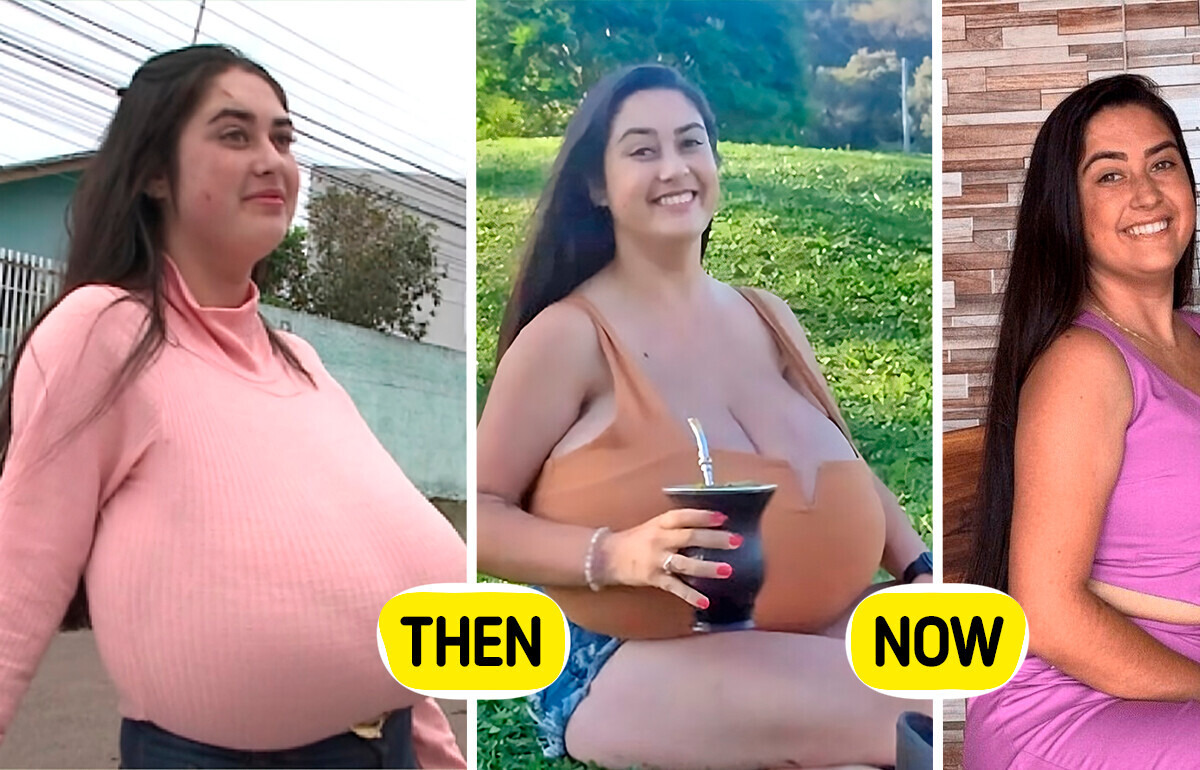 After Removing 10kg (22lbs), She Finally Feels Like Herself Again