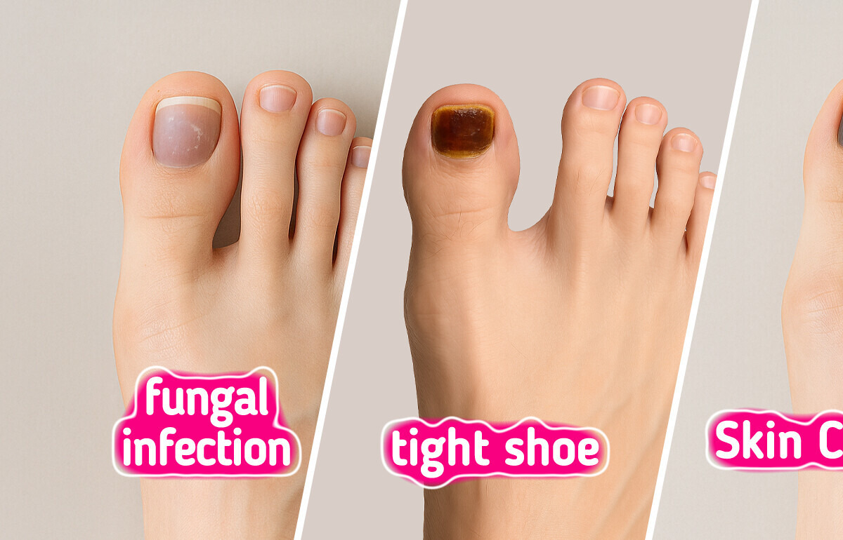 Your Body Trying to Tell You Something Through Your Toenails Your Body Trying to Tell You Something Through Your Toenails