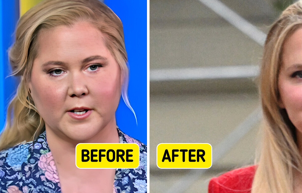 “Looked Better Before!” Amy Schumer Unrecognizable After Major Body Transformation “Looked Better Before!” Amy Schumer Unrecognizable After Major Body Transformation