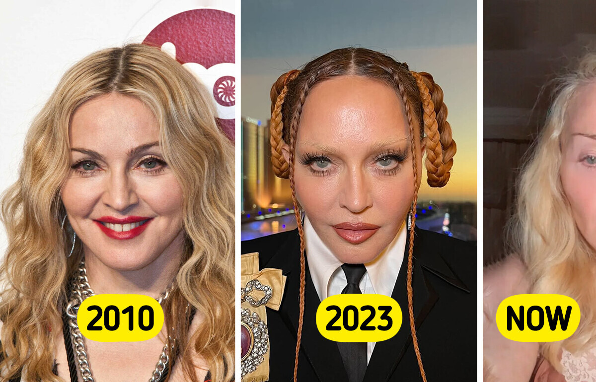 “Not Filler Free,” Fans Noticed One Peculiar Detail After Madonna Revealed Latest Selfie