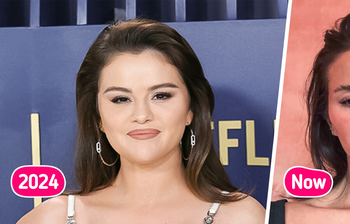 “What Has Selena Done to Her Eyes?” People Can’t Stop Talking About Selena Gomez’s Eyes