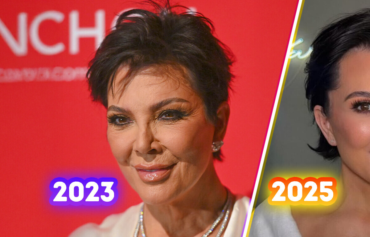 “Best Facelift!” Kris Jenner’s Amazing Surgery Reveal Has Everyone Talking