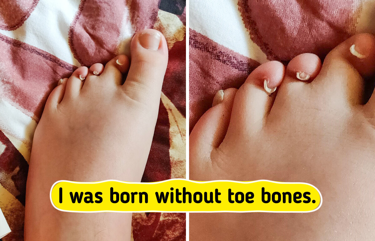 14 People With Truly Unique Features That Instantly Grab Attention