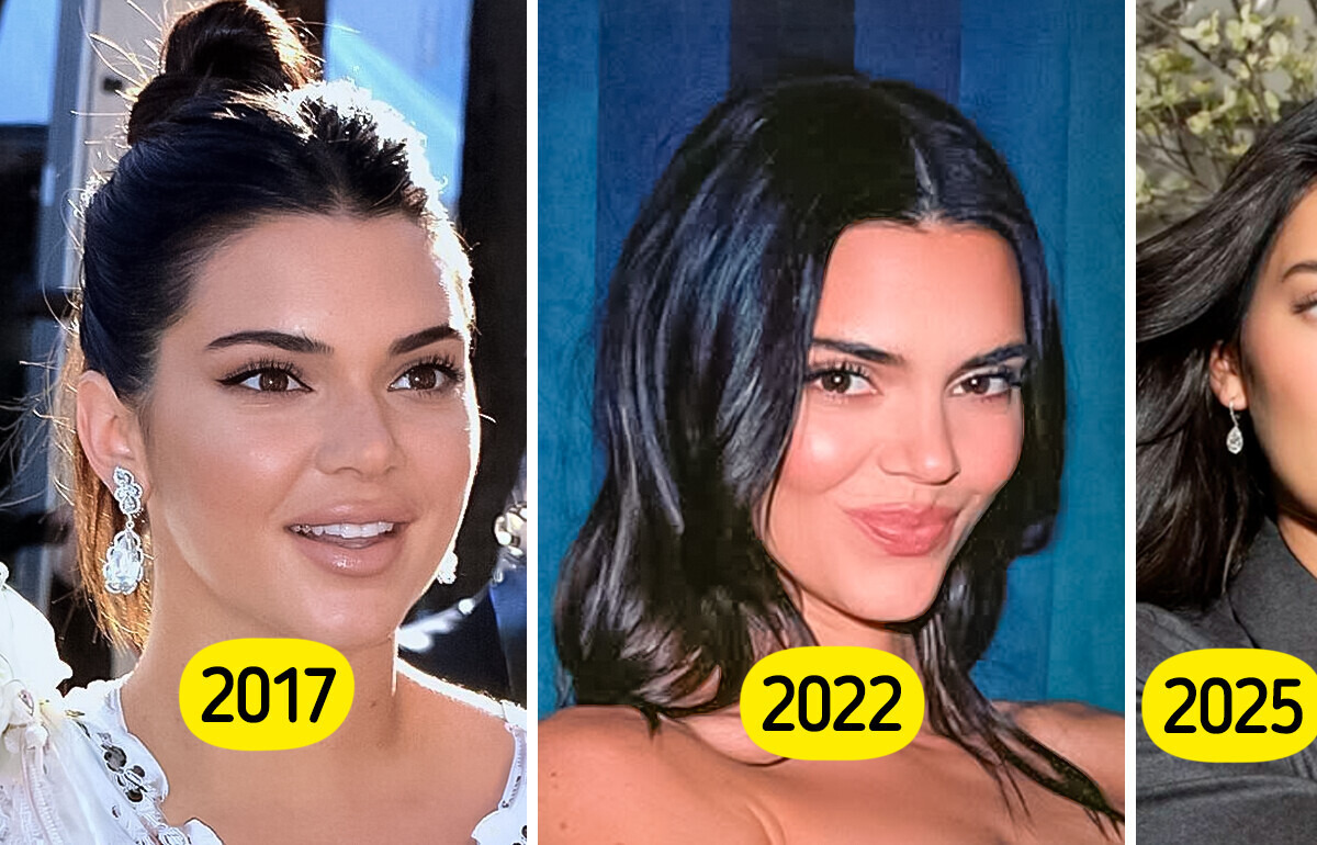 “She Doesn’t Even Look Like The Same Person,” Kendall Jenner Addresses Years Of Nose Job And Filler Rumors