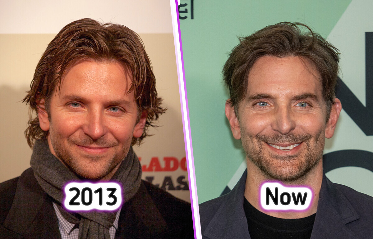 Bradley Cooper, 51, Finally Speaks Out About Ongoing Plastic Surgery Rumors