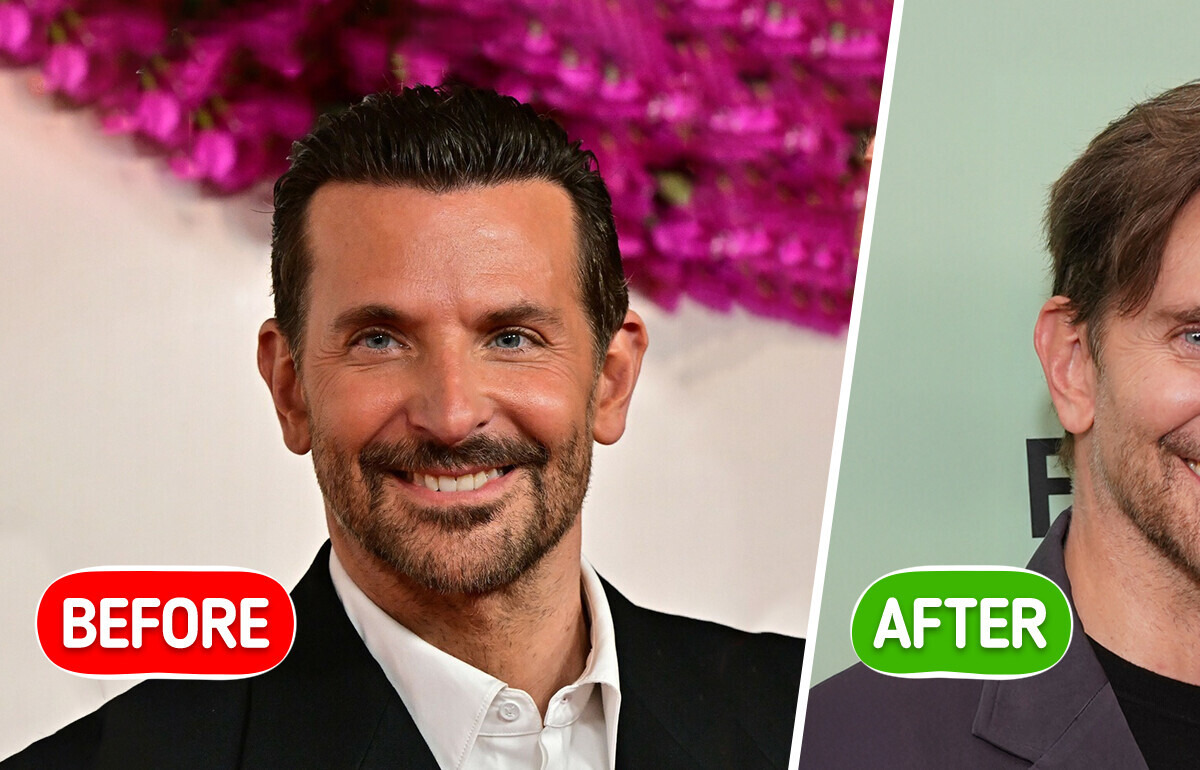 “What Happened to Him?” Bradley Cooper, 50, Debuts a Striking New Look — Plastic Surgery Rumors Swirl