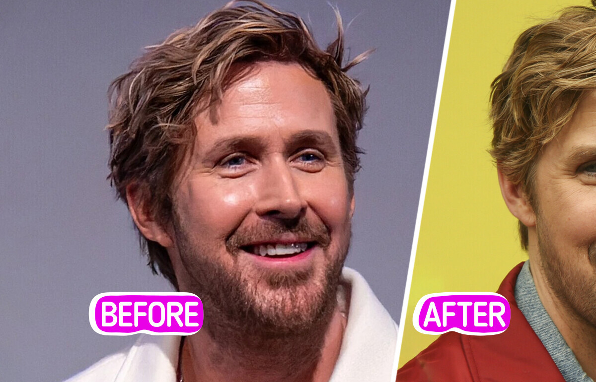 “I Would Not Even Recognize Him!” Gosling’s Puffy Cheeks Trigger PLASTIC SURGERY Debate