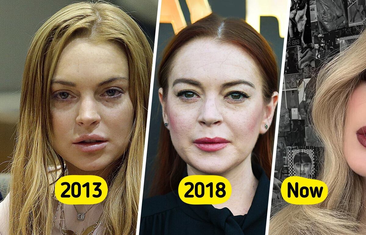 Lindsay Lohan Sparks Heated Buzz with Her New Look — Plastic Surgeon Reveals What She Might Have Done
