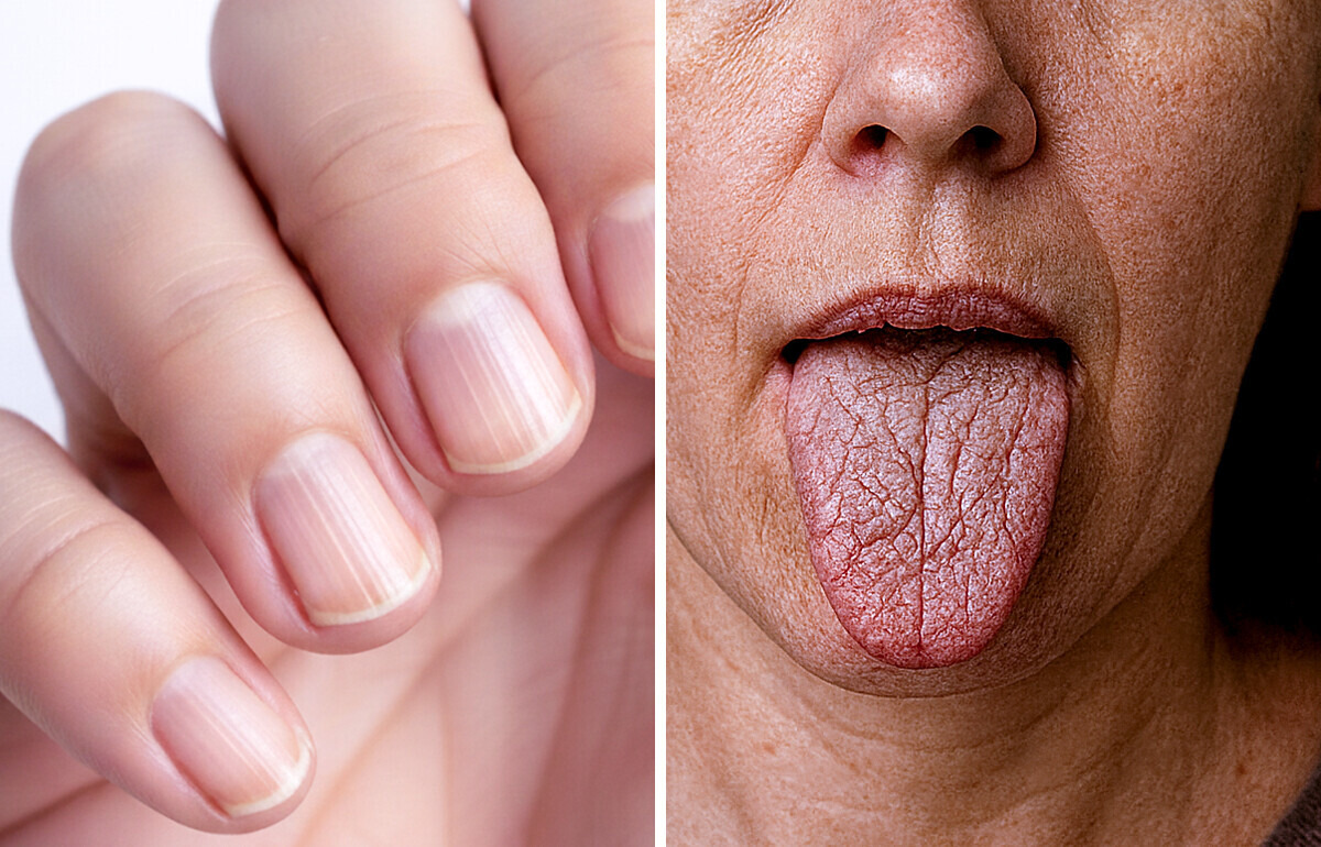 15 Unexpected Body Changes That Prove You’re Aging Exactly As You Should